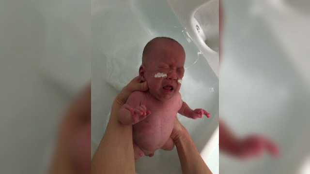 Bebelușul care cântărea 268 de grame la naștere a fost externat. Ce spun părinții - Imaginea 3
