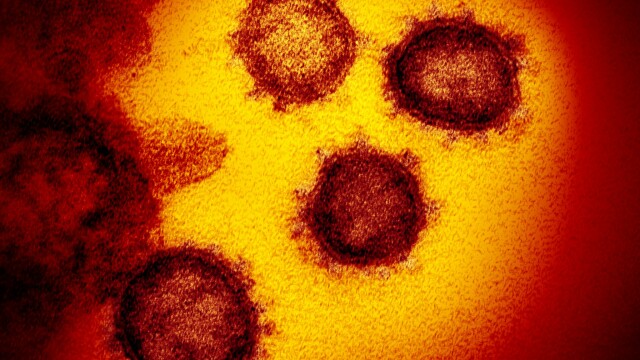 FOTO. Cum arată coronavirusul văzut la microscop. Imaginile publicate de cercetători - Imaginea 1