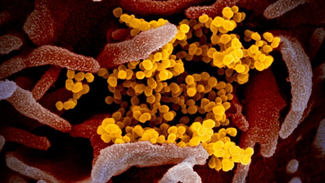 FOTO. Cum arată coronavirusul văzut la microscop. Imaginile publicate de cercetători - Imaginea 3