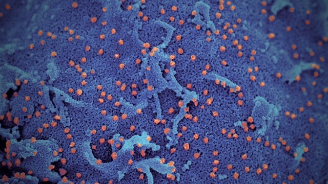 FOTO. Cum arată coronavirusul văzut la microscop. Imaginile publicate de cercetători - Imaginea 5