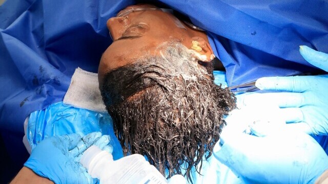 Decizia luată de femeia care și-a dat intenționat cu lipici în cap, după ce un medic a tratat-o gratuit - Imaginea 7