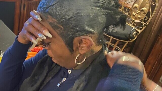 Decizia luată de femeia care și-a dat intenționat cu lipici în cap, după ce un medic a tratat-o gratuit - Imaginea 9
