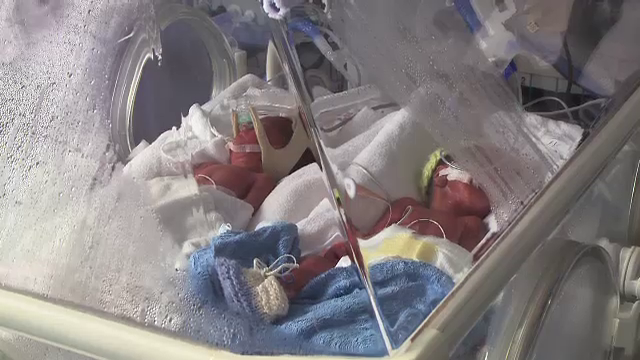Lupta pentru viata la Brasov: medicii vor sa salveze patru frati, toti nascuti in aceeasi zi - Imaginea 3