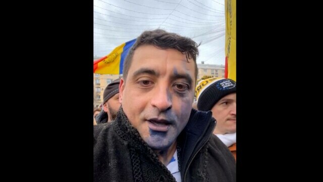 George Simion, atacat cu cerneală la Iași, de Ziua Unirii. Ce a cerut liderul AUR să i se facă agresorului - Imaginea 4