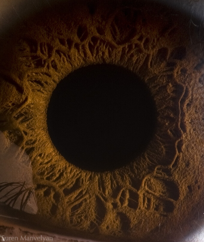 Instrumente optice cu sisteme centrate de lentile: microscopul şi ochiul uman.