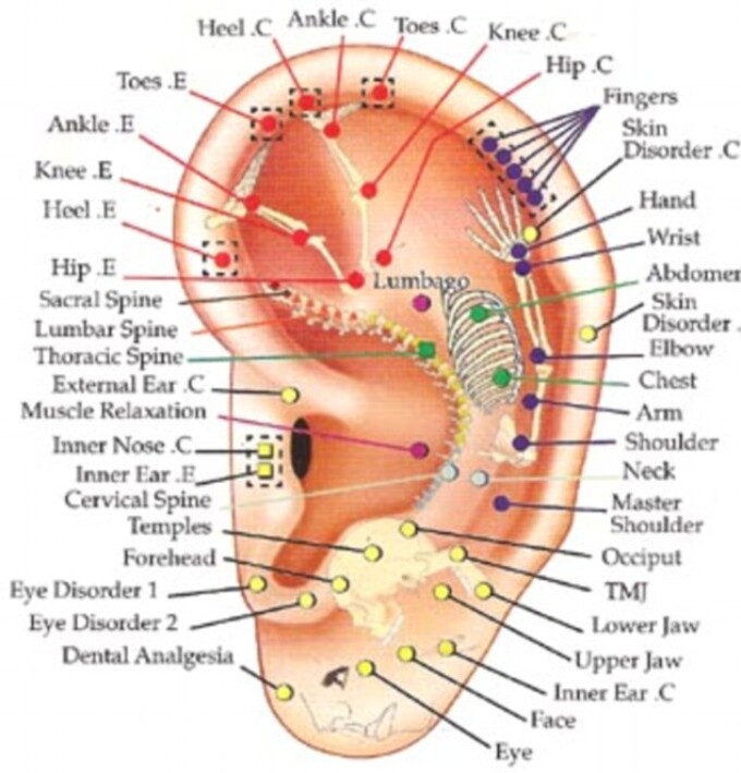 acupunctura in ureche pentru slabit cleanizarea colonului ajută să piardă în greutate