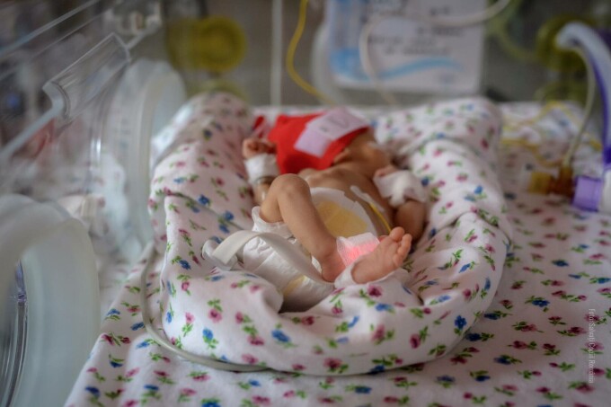 Camera cea mai mică: O șansă la viață pentru copiii prematuri din România.