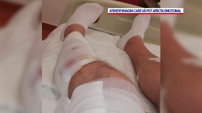 Un bărbat din Cluj a fost mușcat de o haită de câini, în timp ce încerca să-și apere fiica de 6 ani.