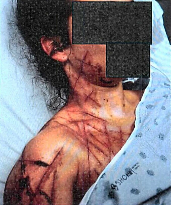 natalie green, tortura