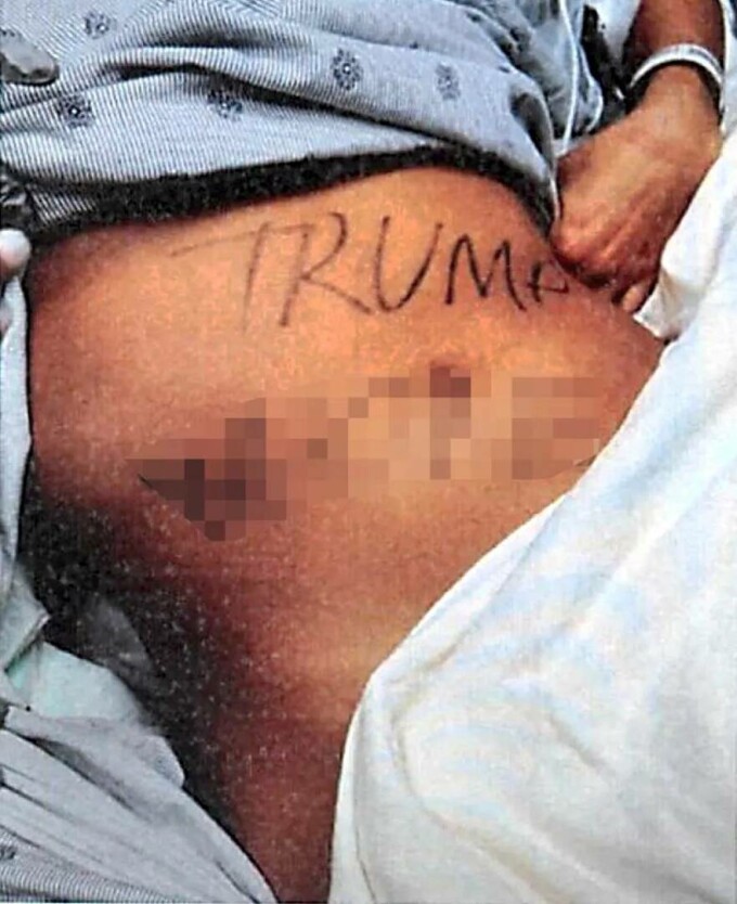 natalie green, tortura