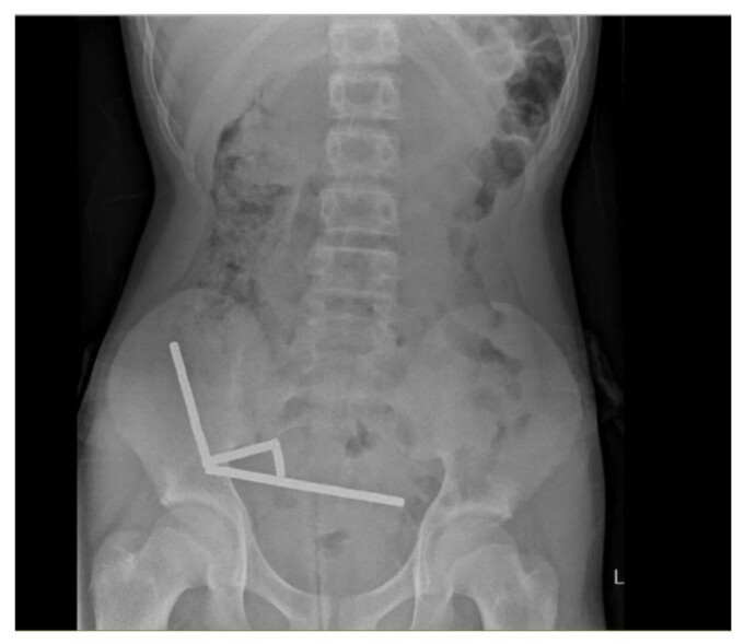 radiografie magneti stomac
