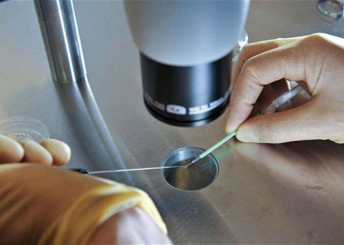 Testul laser care iti spune cat mai ai de trait: