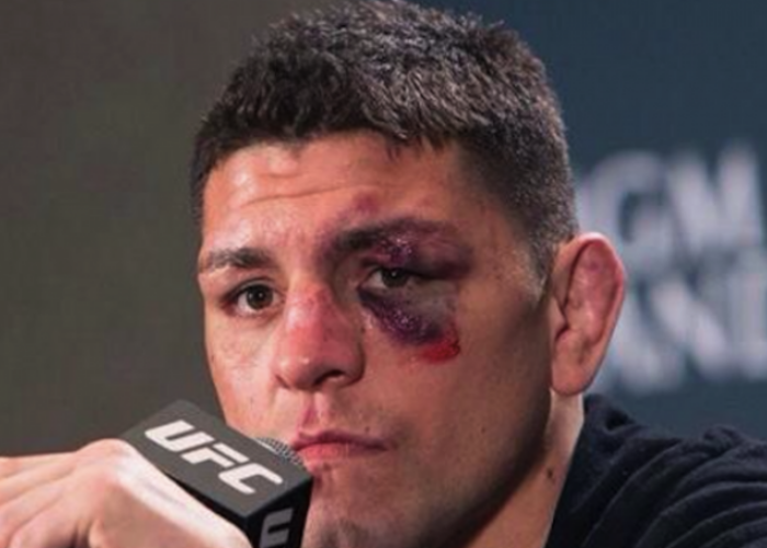 Patru barbati l-au atacat pe luptatorul din MMA, Nick Diaz, intr-un club: Nu cred ca stiau ei cine sunt!