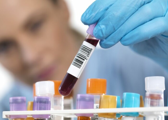 Descoperire revolutionara privind cancerul