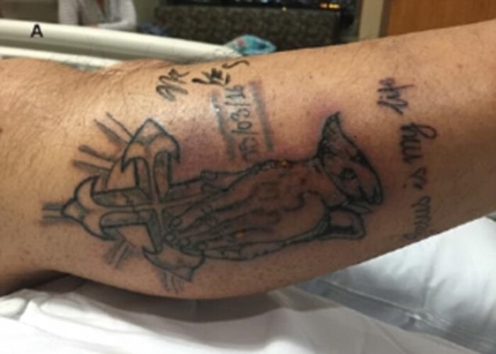 Un barbat a murit la putin timp dupa ce si-a facut un tatuaj! Sfatul pe care l-a ignorat