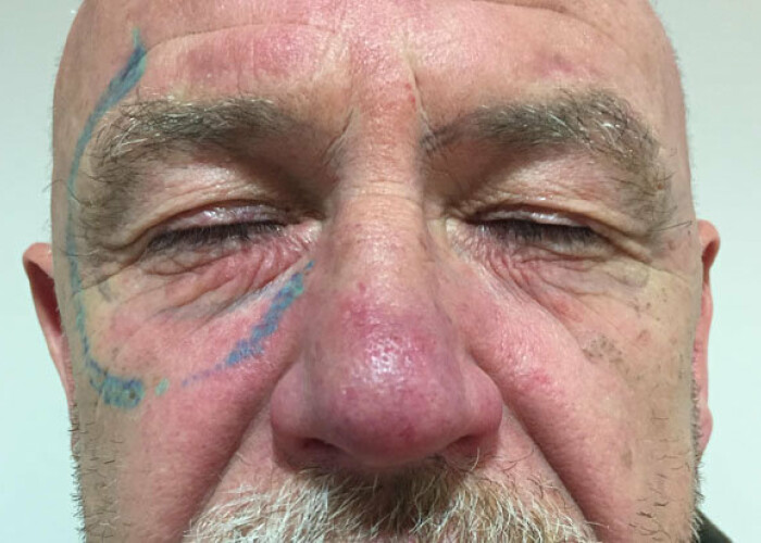Hangover 4! Ce si-a tatuat un barbat pe fata dupa o noapte de pomina