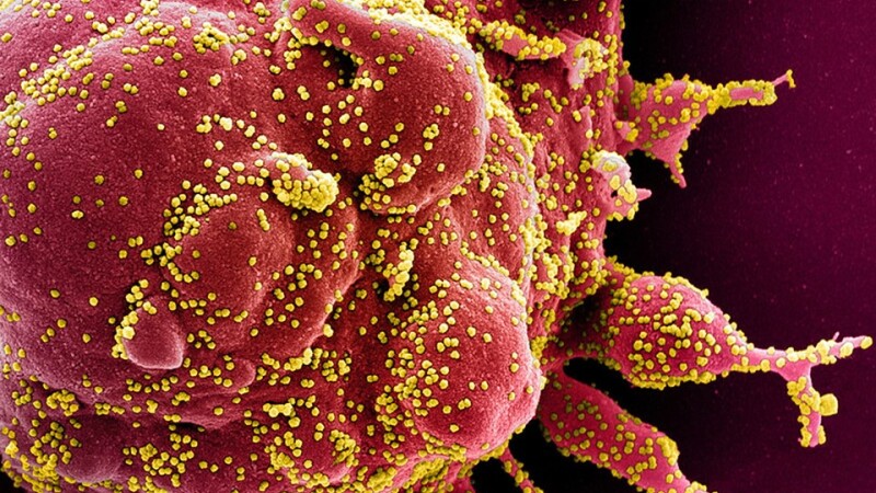 Oamenii de știință au făcut publică imaginea color a unei celule (roșu) infectate cu coronavirus (galben)