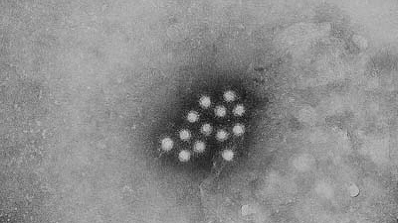 Virusul hepatitei A