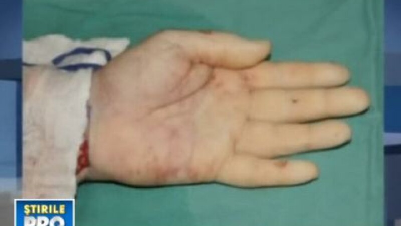 Transplant de mana