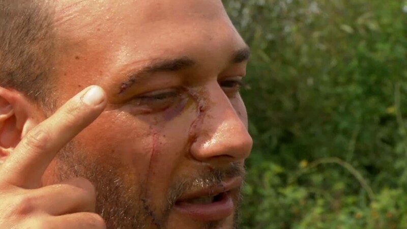 Barbat atacat de urs