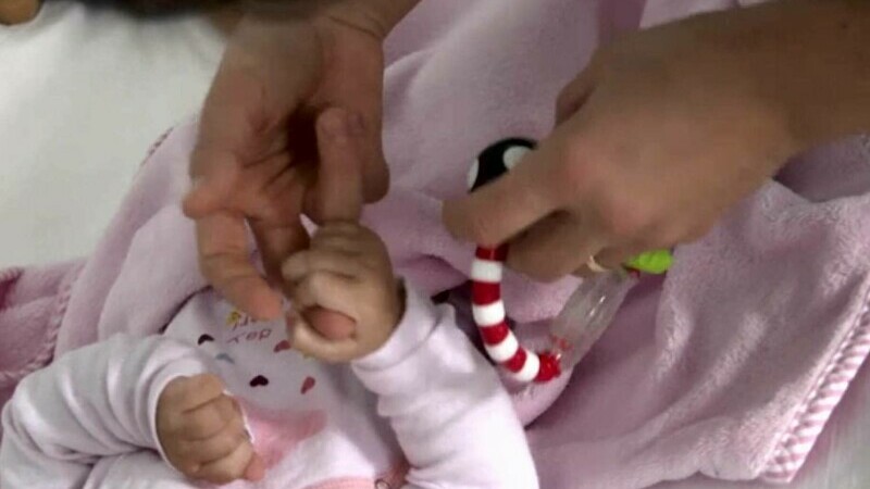 Miruna, fetița de șase luni din Galați, salvată cu o operație complicată pe creier. Ajunsese în comă la spitalul din Iași