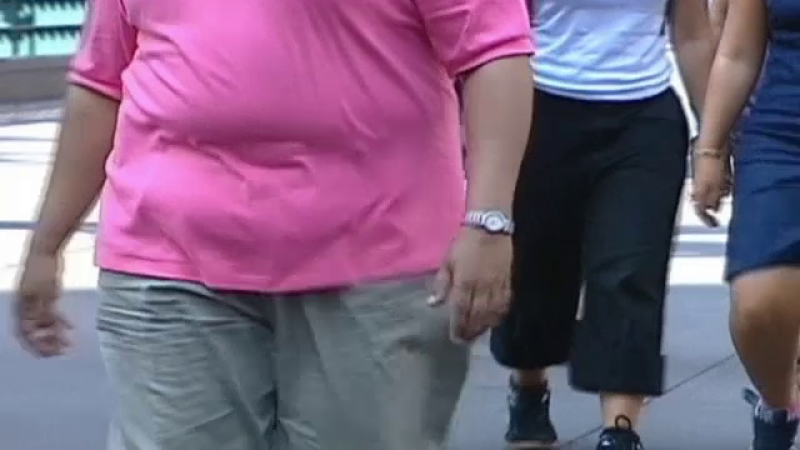 Obezitate