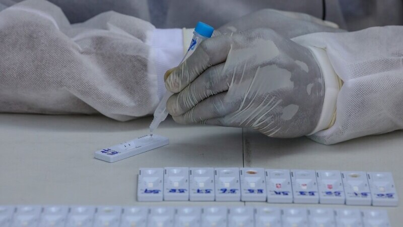 test antigen pentru Covid-19