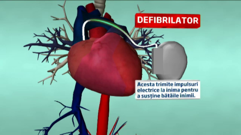 defibrilator cardiac
