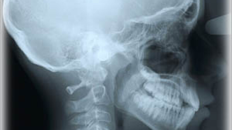 radiografie craniana