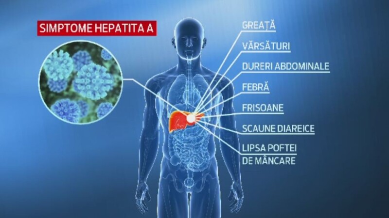 Simptome Hepatita A
