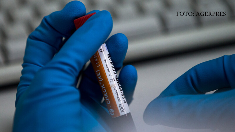 fiola test antidoping