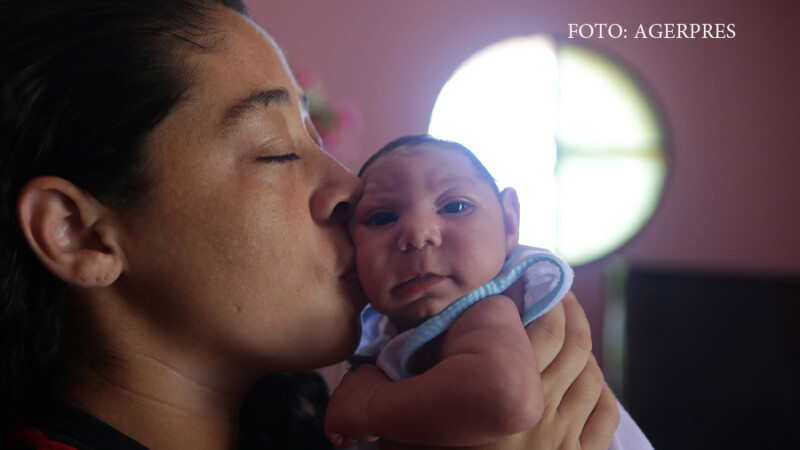 mama tinand in brate un copil cu microcefalie provocata de Zika