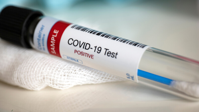 Test coronavirus