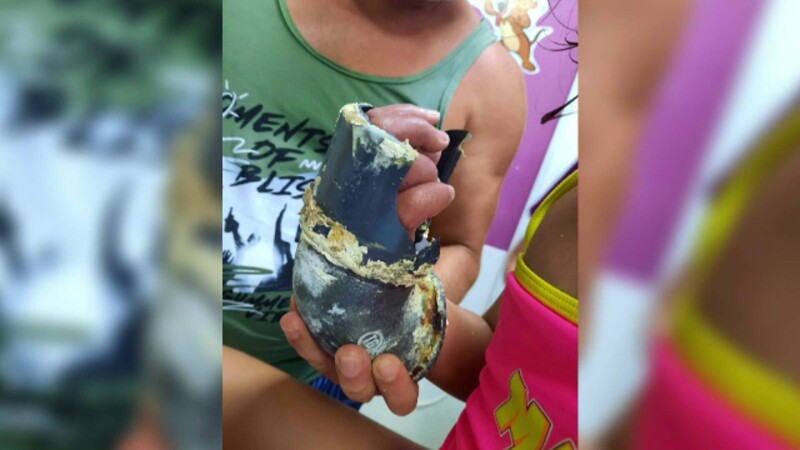 O fetiţă în vârstă de 5 ani a rămas cu mâna prinsă în tubul de absorţie al unei piscine, la un hotel din Mamaia