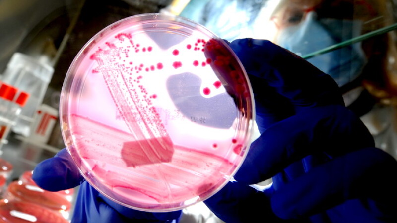 Bacteria e-coli