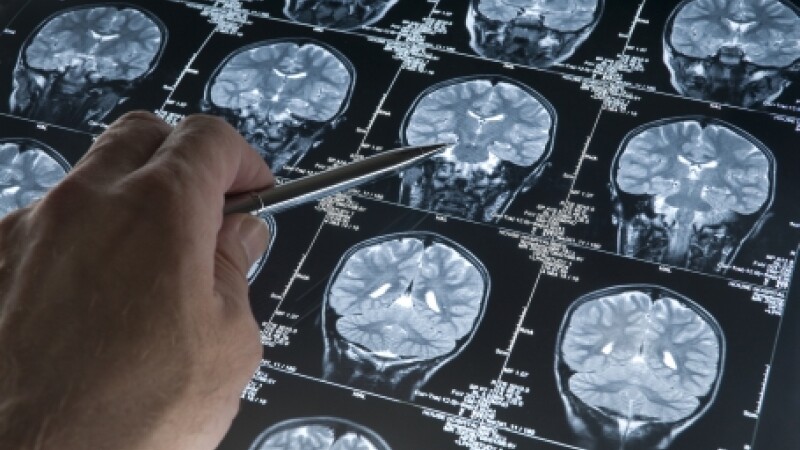 tomografie creier