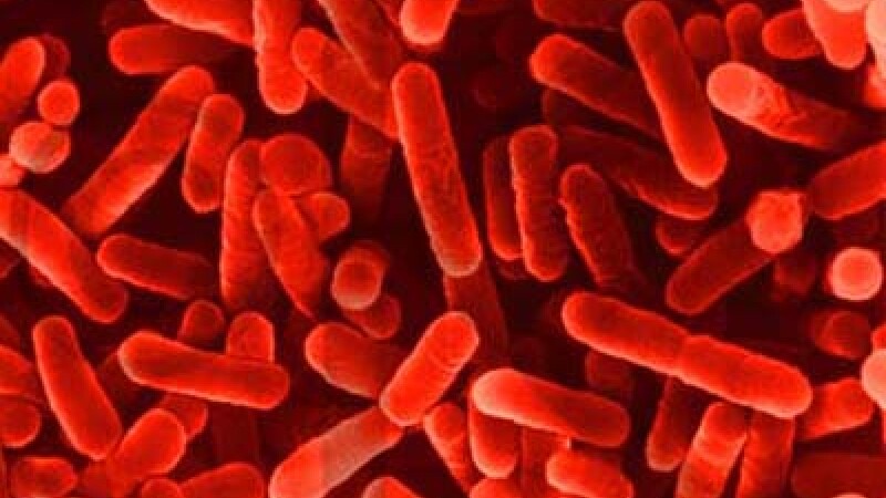 Legionella