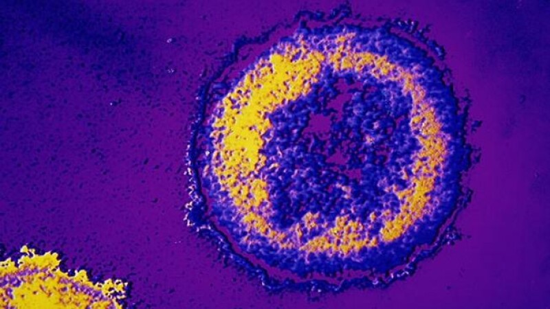 virus, HIV