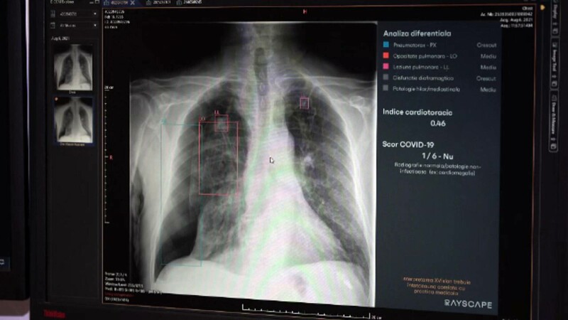 spital