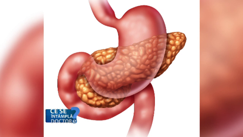 pancreas csid