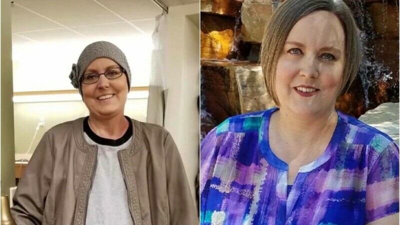 mama cancer
