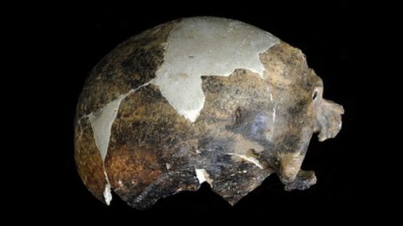 craniu