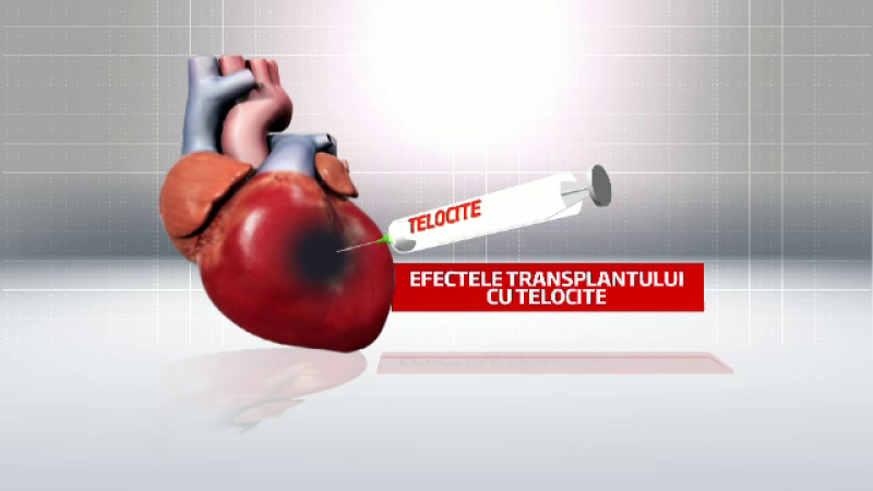 telocite