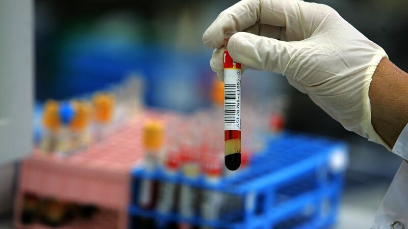 Marea Britanie introduce testul de sânge care poate depista peste 50 de forme de cancer în formă incipientă