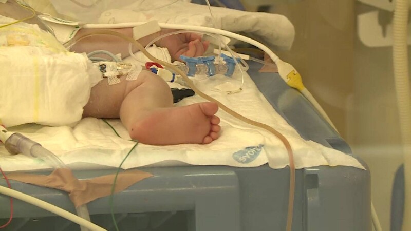 bebelusi prematuri
