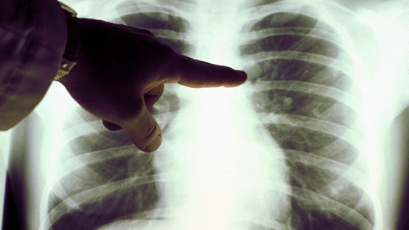 Radiografie