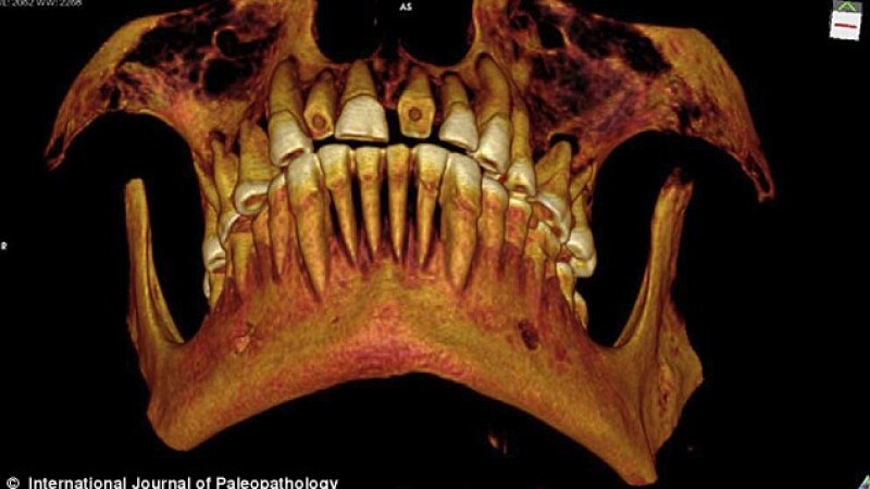 craniu mumie egipteana, dinti