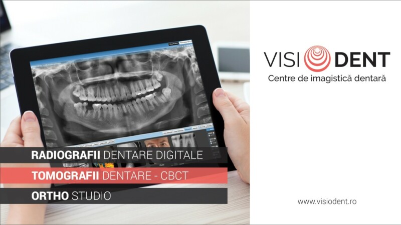 (P) Visiodent deschide al cincelea centru de imagistică dentară în București
