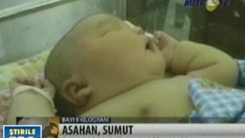 Record in Indonezia! O femeie a nascut un bebelus gigant, de 8,7 kg!