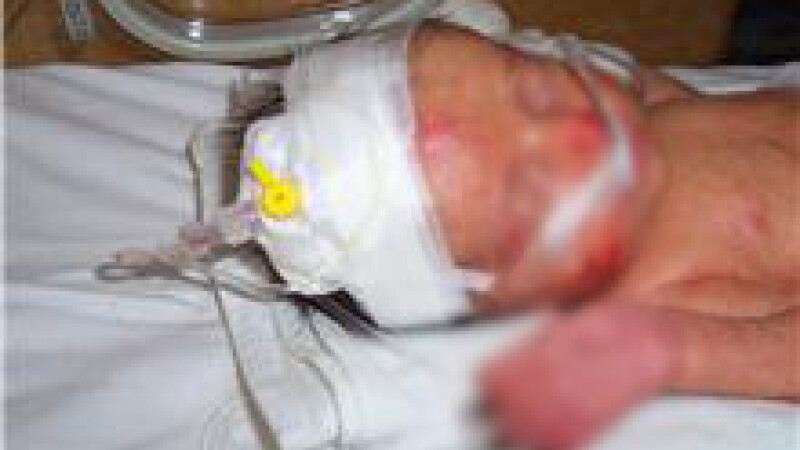 Imagini cu bebelusii raniti la Maternitatea Giulesti